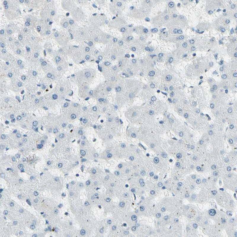 RNF43 Antibody - BSA Free Immunohistochemistry-Paraffin: RNF43 Antibody [NBP1-85018]