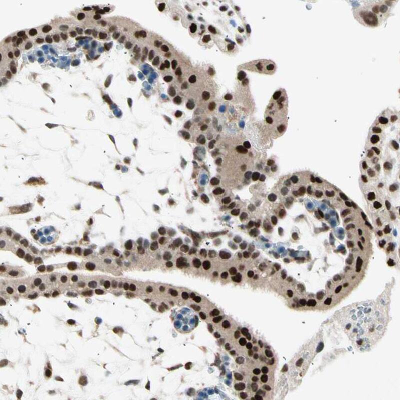 RNF43 Antibody - BSA Free Immunohistochemistry-Paraffin: RNF43 Antibody [NBP1-85018]