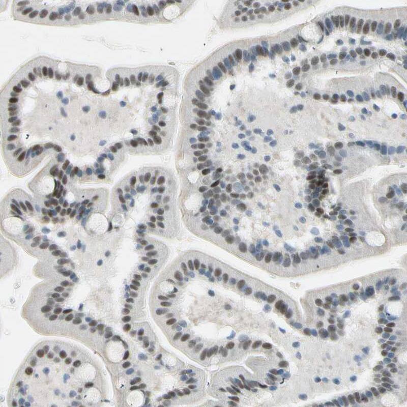RNF43 Antibody - BSA Free Immunohistochemistry-Paraffin: RNF43 Antibody [NBP1-85018]