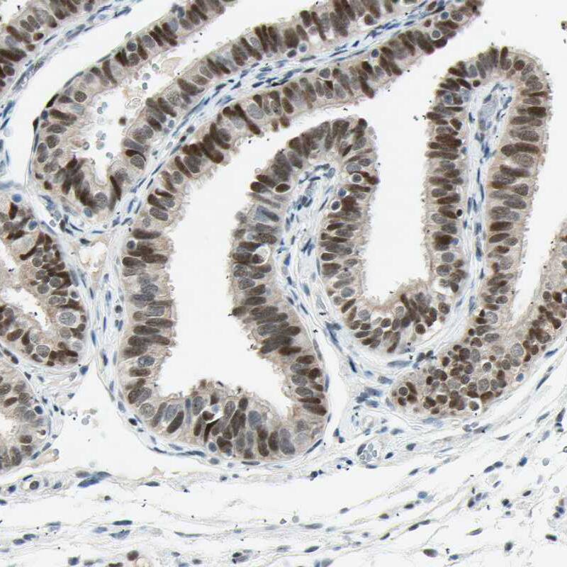 RNF43 Antibody - BSA Free Immunohistochemistry-Paraffin: RNF43 Antibody [NBP1-85018]