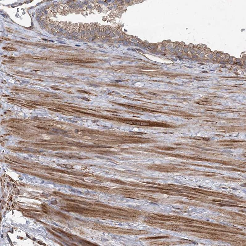 PLEKHA7 Antibody - BSA Free Immunohistochemistry-Paraffin: PLEKHA7 Antibody [NBP1-85045]
