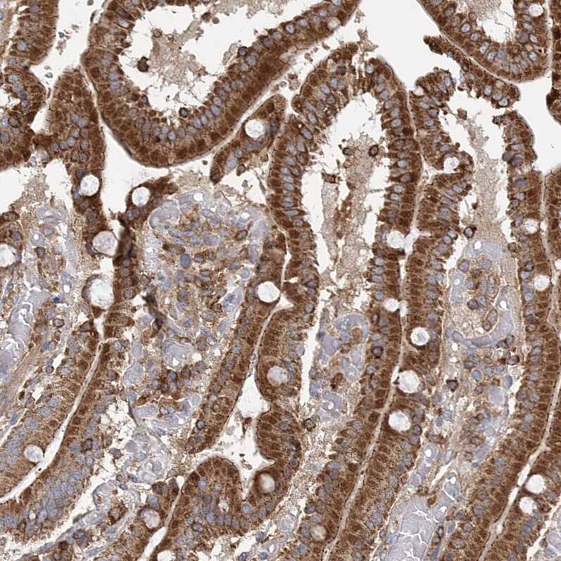 PLEKHA7 Antibody - BSA Free Immunohistochemistry-Paraffin: PLEKHA7 Antibody [NBP1-85045]