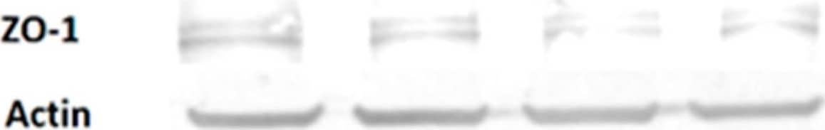 Tight Junction Protein 1 Antibody