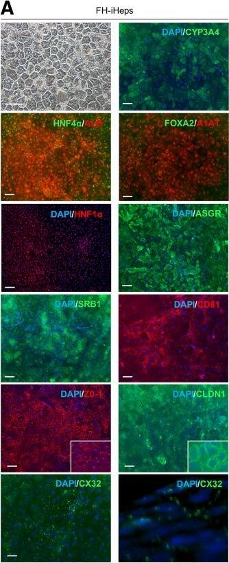 Tight Junction Protein 1 Antibody