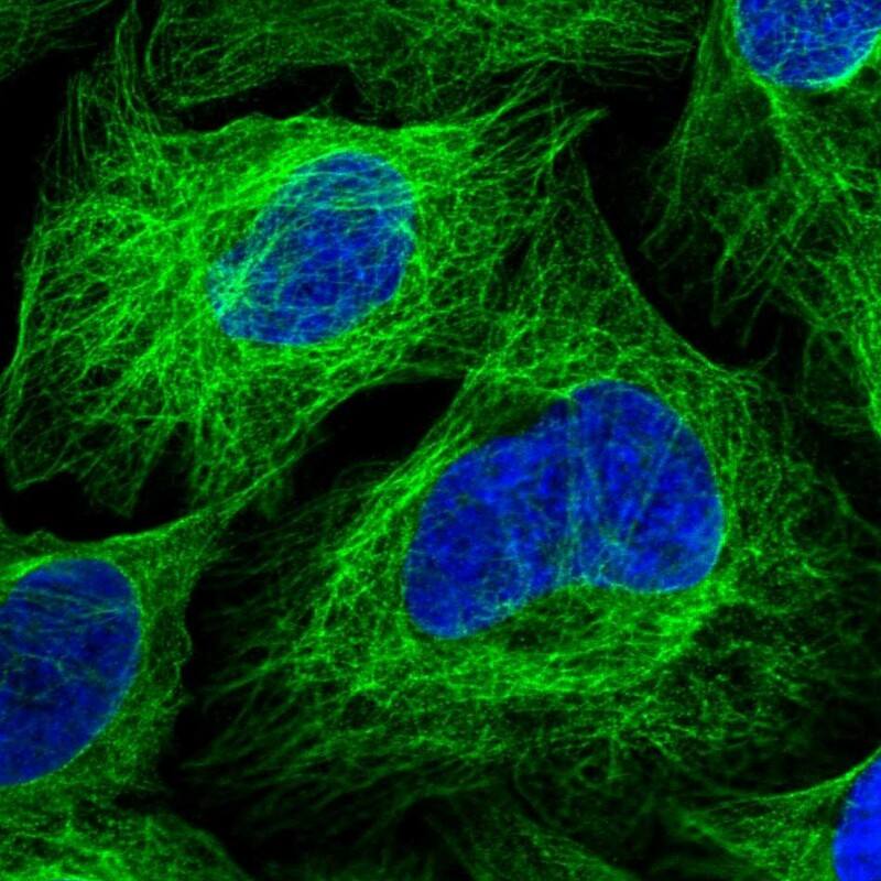 ZDHHC18 Antibody - BSA Free Immunocytochemistry/ Immunofluorescence: ZDHHC18 Antibody [NBP1-85057]