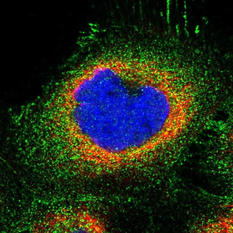ZNF783 Antibody - BSA Free Immunocytochemistry/ Immunofluorescence: ZNF783 Antibody [NBP1-85058]