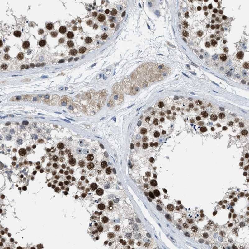ZNF783 Antibody - BSA Free Immunohistochemistry-Paraffin: ZNF783 Antibody [NBP1-85058]