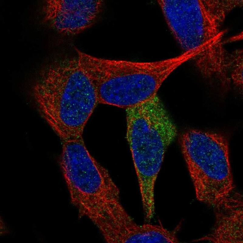 p53 DINP1 Antibody - BSA Free Immunocytochemistry/ Immunofluorescence: p53 DINP1 Antibody [NBP1-85108]