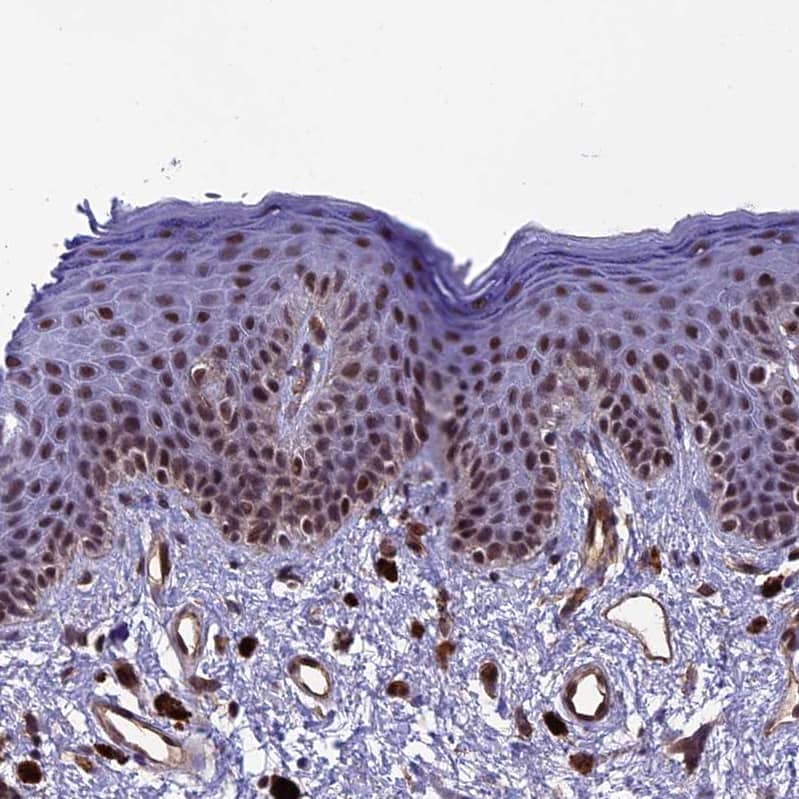 NIPBL Antibody - BSA Free Immunohistochemistry-Paraffin: NIPBL Antibody [NBP1-85110]