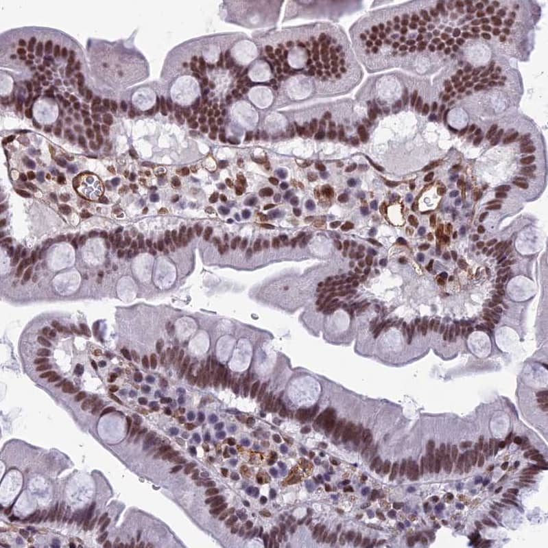 NIPBL Antibody - BSA Free Immunohistochemistry-Paraffin: NIPBL Antibody [NBP1-85110]