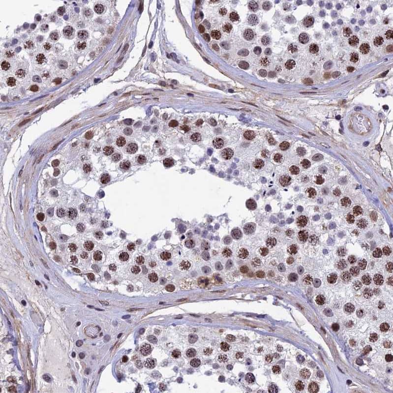 NIPBL Antibody - BSA Free Immunohistochemistry-Paraffin: NIPBL Antibody [NBP1-85110]