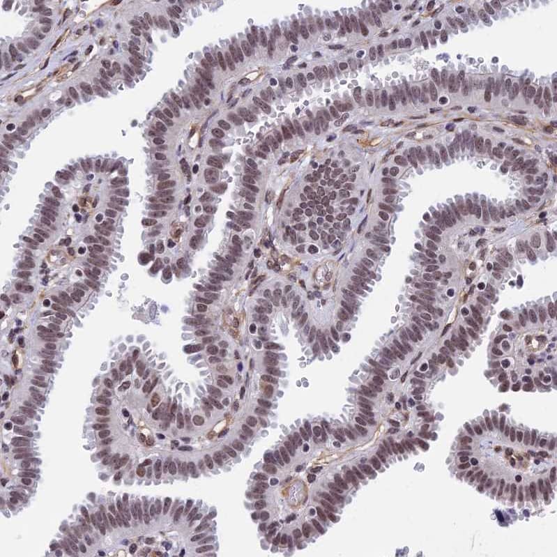 NIPBL Antibody - BSA Free Immunohistochemistry-Paraffin: NIPBL Antibody [NBP1-85110]