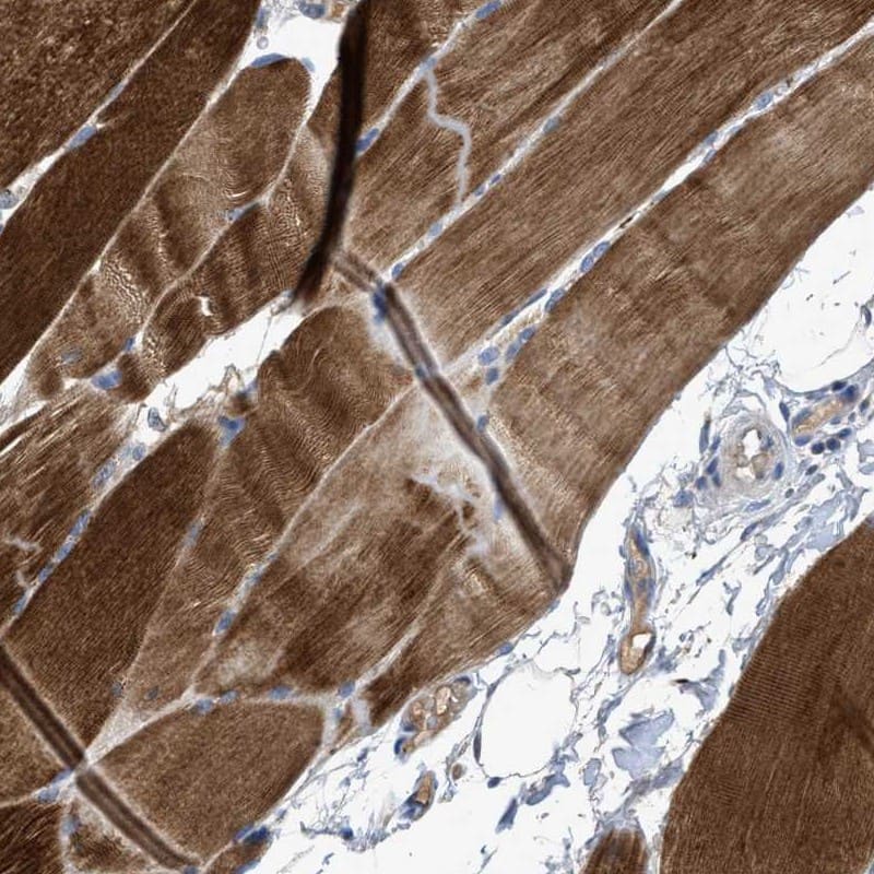 SNF1LK2/SIK2 Antibody - BSA Free Immunohistochemistry-Paraffin: SNF1LK2/SIK2 Antibody [NBP1-85114]