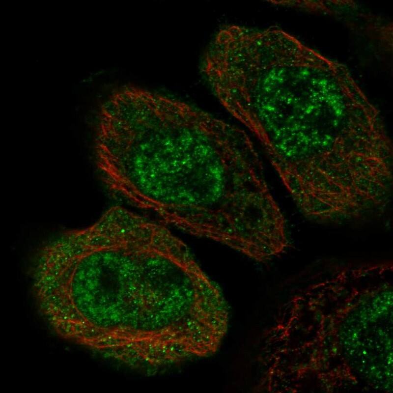 ZNF543 Antibody - BSA Free Immunocytochemistry/ Immunofluorescence: ZNF543 Antibody [NBP1-85122]