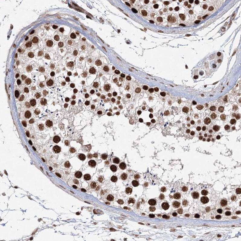 ZCCHC8 Antibody Immunohistochemistry-Paraffin: ZCCHC8 Antibody [NBP1-85135]
