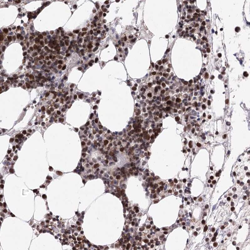 ZCCHC8 Antibody Immunohistochemistry-Paraffin: ZCCHC8 Antibody [NBP1-85135]