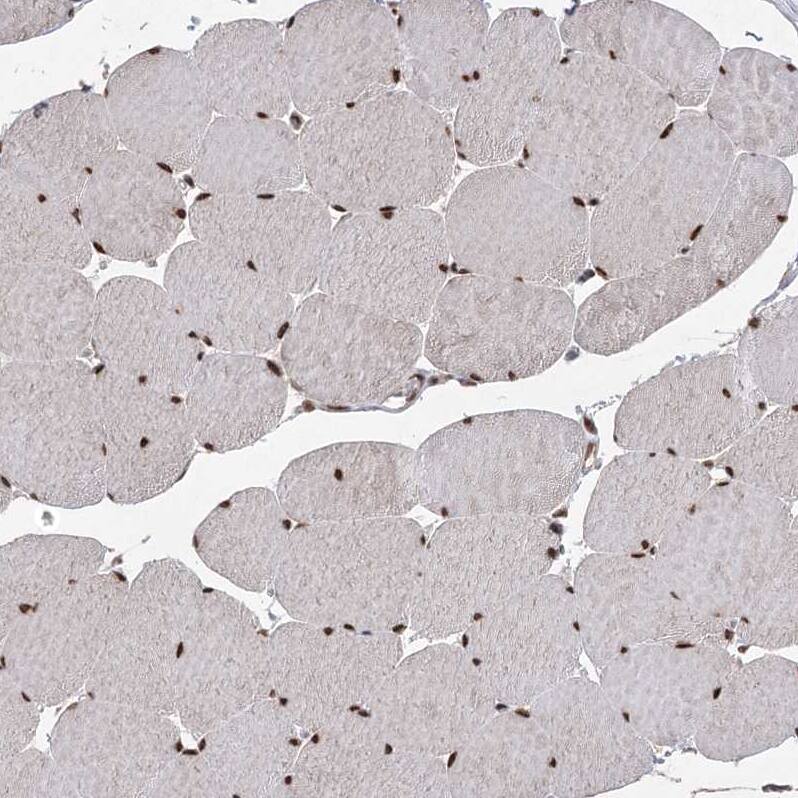 ZCCHC8 Antibody Immunohistochemistry-Paraffin: ZCCHC8 Antibody [NBP1-85135]