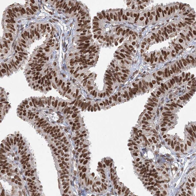 ZCCHC8 Antibody Immunohistochemistry-Paraffin: ZCCHC8 Antibody [NBP1-85135]