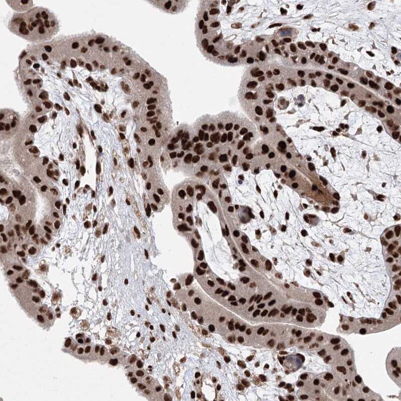 ZCCHC8 Antibody Immunohistochemistry-Paraffin: ZCCHC8 Antibody [NBP1-85135]