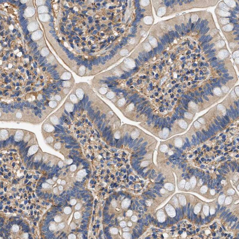 Septin-2 Antibody - BSA Free Immunohistochemistry-Paraffin: Septin-2 Antibody [NBP1-85212]