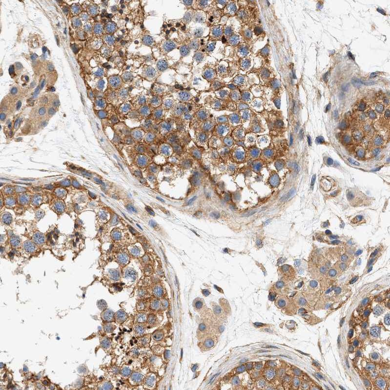 Septin-2 Antibody - BSA Free Immunohistochemistry-Paraffin: Septin-2 Antibody [NBP1-85212]