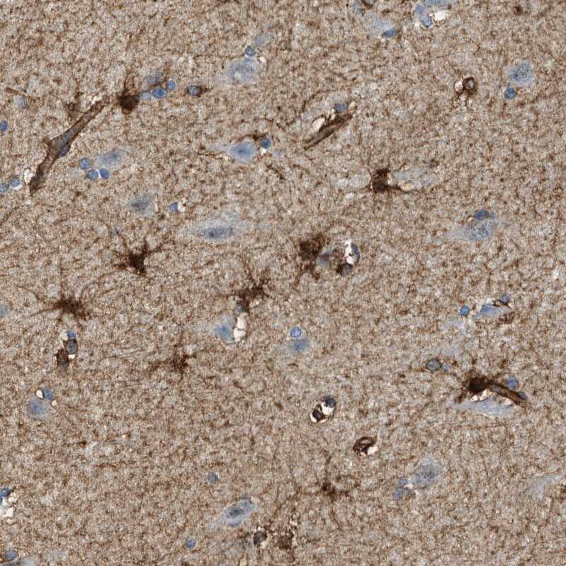 Septin-2 Antibody - BSA Free Immunohistochemistry-Paraffin: Septin-2 Antibody [NBP1-85212]