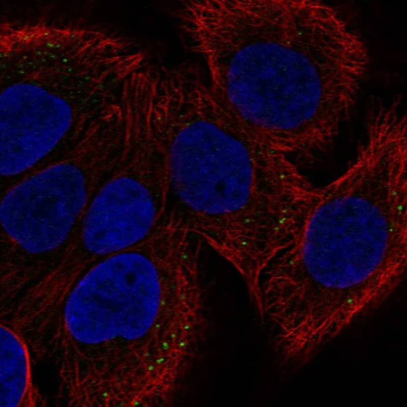 ST2/IL-33R Antibody - BSA Free Immunocytochemistry/ Immunofluorescence: ST2/IL-33R Antibody [NBP1-85252]