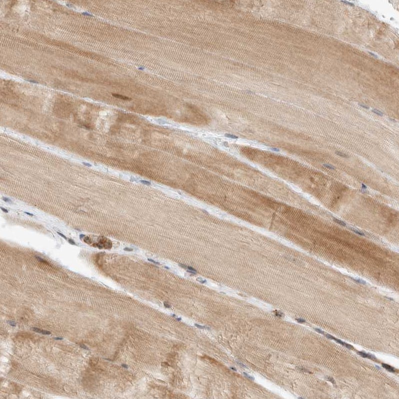 DEPTOR/DEPDC6 Antibody - BSA Free Immunohistochemistry-Paraffin: DEPTOR/DEPDC6 Antibody [NBP1-85257]