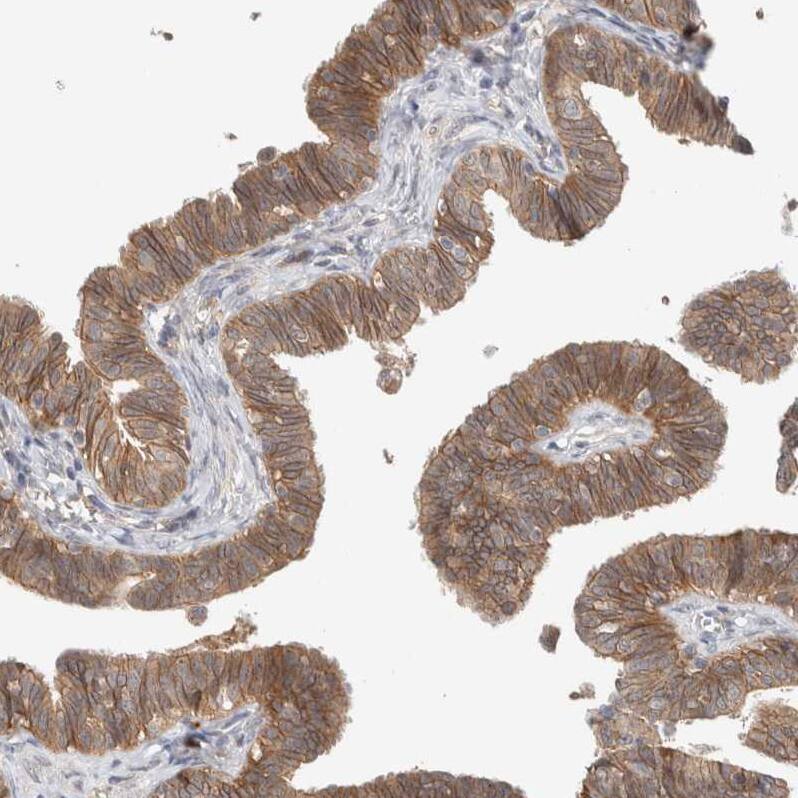 DEPTOR/DEPDC6 Antibody - BSA Free Immunohistochemistry-Paraffin: DEPTOR/DEPDC6 Antibody [NBP1-85257]