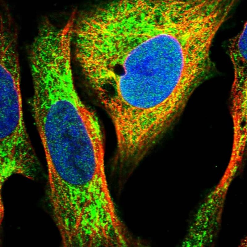 DECR1 Antibody - BSA Free Immunocytochemistry/ Immunofluorescence: DECR1 Antibody [NBP1-85263]