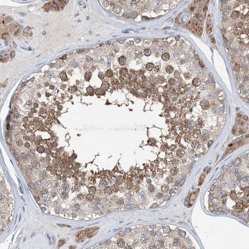 DHX30 Antibody - BSA Free Immunohistochemistry-Paraffin: DHX30 Antibody [NBP1-85270]
