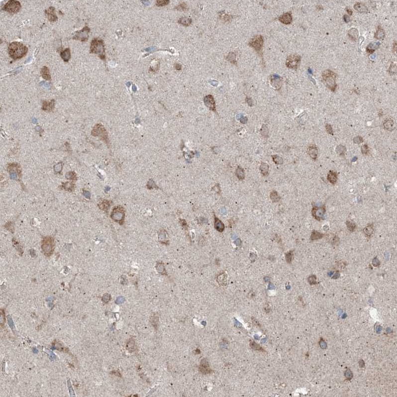 DHX30 Antibody - BSA Free Immunohistochemistry-Paraffin: DHX30 Antibody [NBP1-85270]