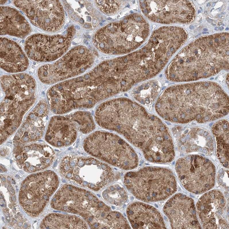 DHX30 Antibody - BSA Free Immunohistochemistry-Paraffin: DHX30 Antibody [NBP1-85270]