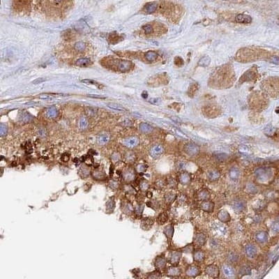Dynactin Subunit 2/DCTN2/DCTN-50 Antibody - BSA Free Immunohistochemistry-Paraffin: Dynactin Subunit 2/DCTN2/DCTN-50 Antibody [NBP1-85278]