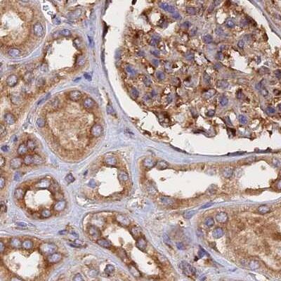 Dynactin Subunit 2/DCTN2/DCTN-50 Antibody - BSA Free Immunohistochemistry-Paraffin: Dynactin Subunit 2/DCTN2/DCTN-50 Antibody [NBP1-85278]