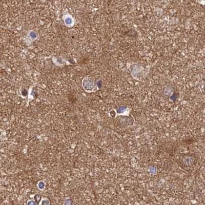 Dynactin Subunit 2/DCTN2/DCTN-50 Antibody - BSA Free Immunohistochemistry-Paraffin: Dynactin Subunit 2/DCTN2/DCTN-50 Antibody [NBP1-85278]
