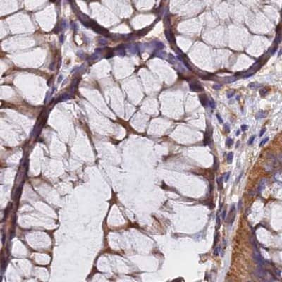 Dynactin Subunit 2/DCTN2/DCTN-50 Antibody - BSA Free Immunohistochemistry-Paraffin: Dynactin Subunit 2/DCTN2/DCTN-50 Antibody [NBP1-85278]
