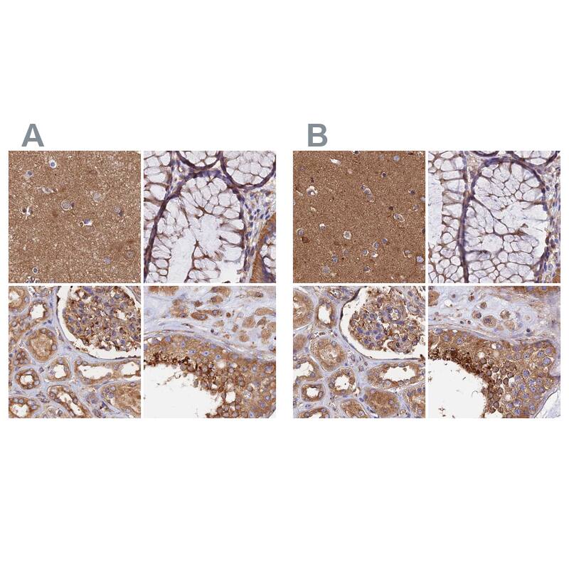Dynactin Subunit 2/DCTN2/DCTN-50 Antibody - BSA Free Immunohistochemistry-Paraffin: Dynactin Subunit 2/DCTN2/DCTN-50 Antibody [NBP1-85278]
