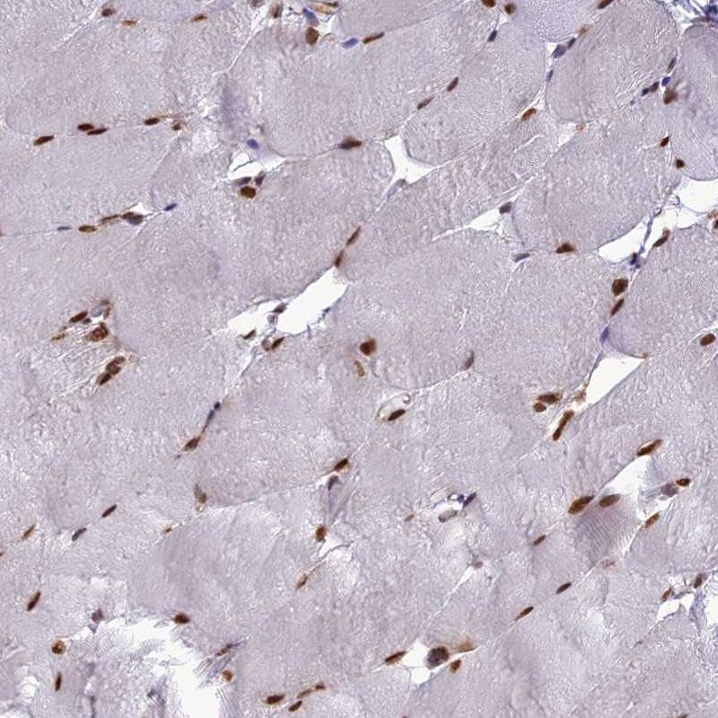 DDX1 Antibody - BSA Free Immunohistochemistry-Paraffin: DDX1 Antibody [NBP1-85293]