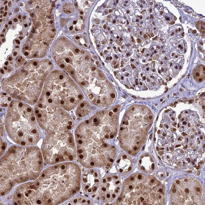 DDX1 Antibody - BSA Free Immunohistochemistry-Paraffin: DDX1 Antibody [NBP1-85293]