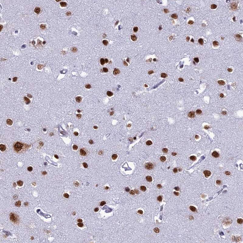 DDX1 Antibody - BSA Free Immunohistochemistry-Paraffin: DDX1 Antibody [NBP1-85293]