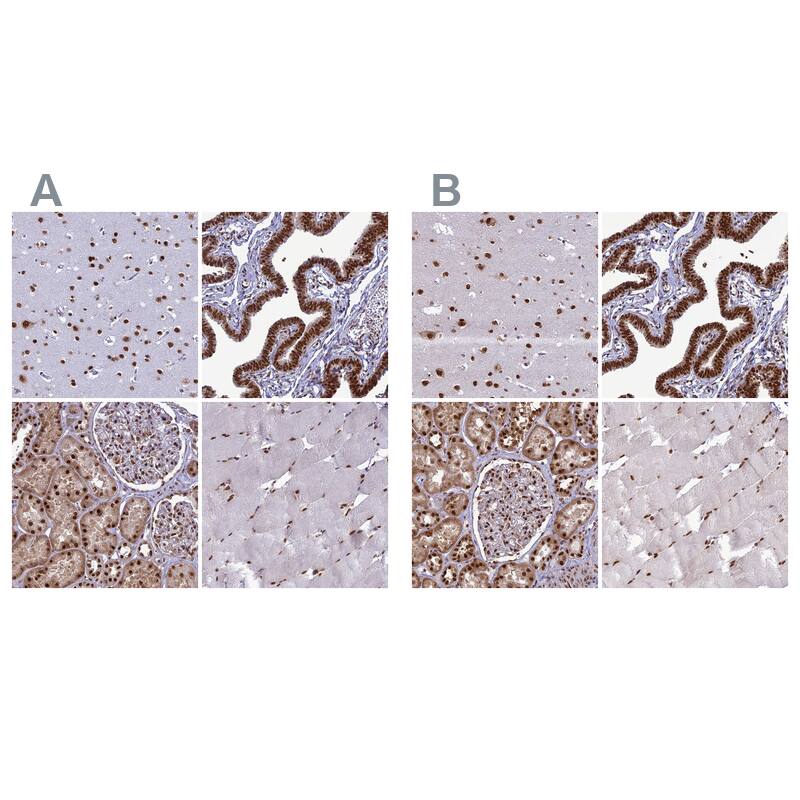 DDX1 Antibody - BSA Free Immunohistochemistry-Paraffin: DDX1 Antibody [NBP1-85293]