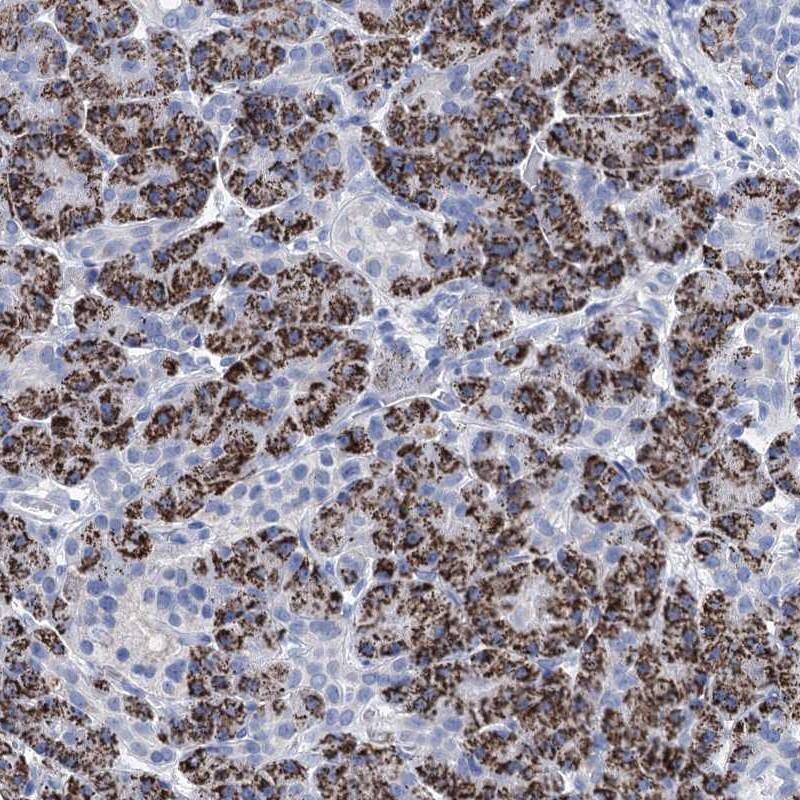 DBC1 Antibody - BSA Free Immunohistochemistry-Paraffin: DBC1 Antibody [NBP1-85303]