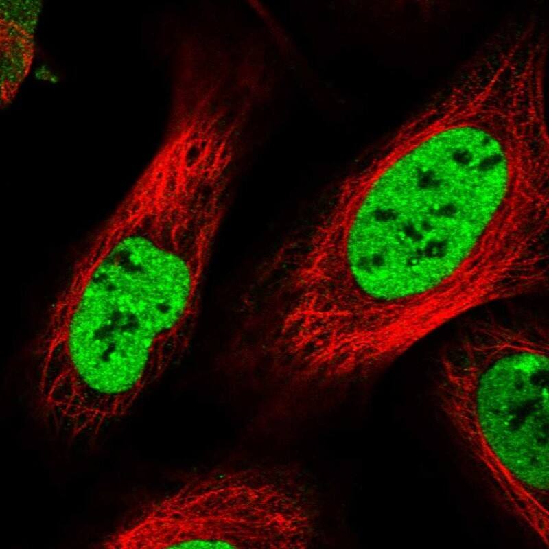 DBC1/p30 Antibody Immunocytochemistry/ Immunofluorescence: DBC1/p30 Antibody Antibody [NBP1-85305]