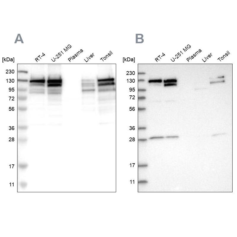 DBC1/p30 Antibody Western Blot: DBC1/p30 Antibody Antibody [NBP1-85305]