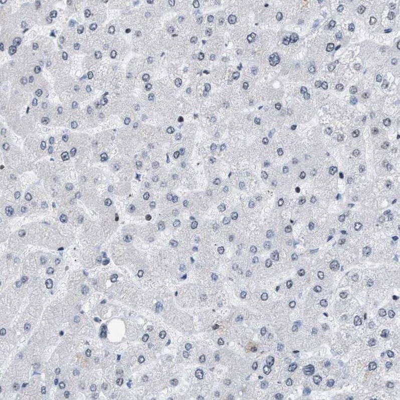 DBC1/p30 Antibody Immunohistochemistry-Paraffin: DBC1/p30 Antibody [NBP1-85305]