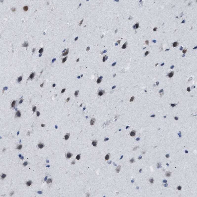 DBC1/p30 Antibody Immunohistochemistry-Paraffin: DBC1/p30 Antibody [NBP1-85305]