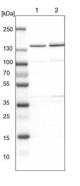 DBC1/p30 Antibody Western Blot: DBC1/p30 Antibody [NBP1-85305]