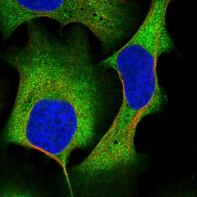 AKAP10 Antibody - BSA Free Immunocytochemistry/ Immunofluorescence: AKAP10 Antibody [NBP1-85314]