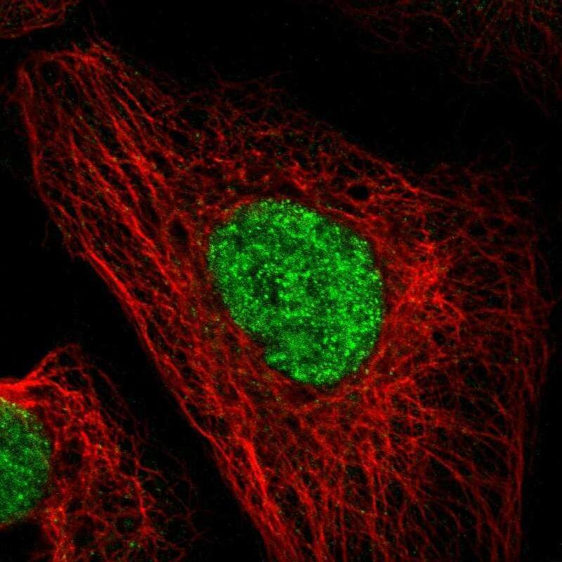 DACH1 Antibody - BSA Free Immunocytochemistry/ Immunofluorescence: DACH1 Antibody [NBP1-85320]